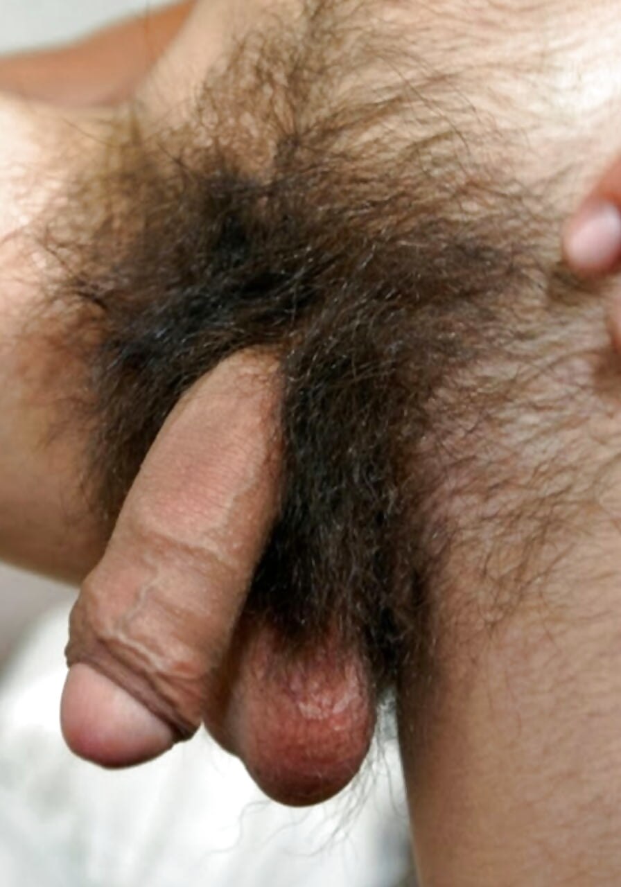 Hairy genitals