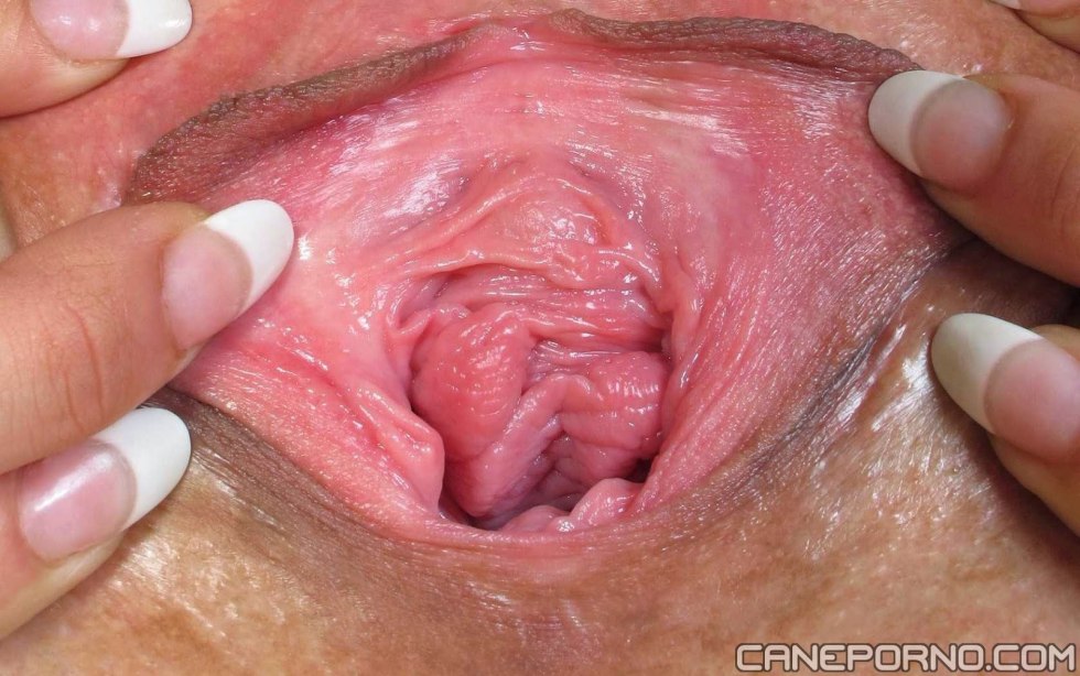The insides of the vagina
