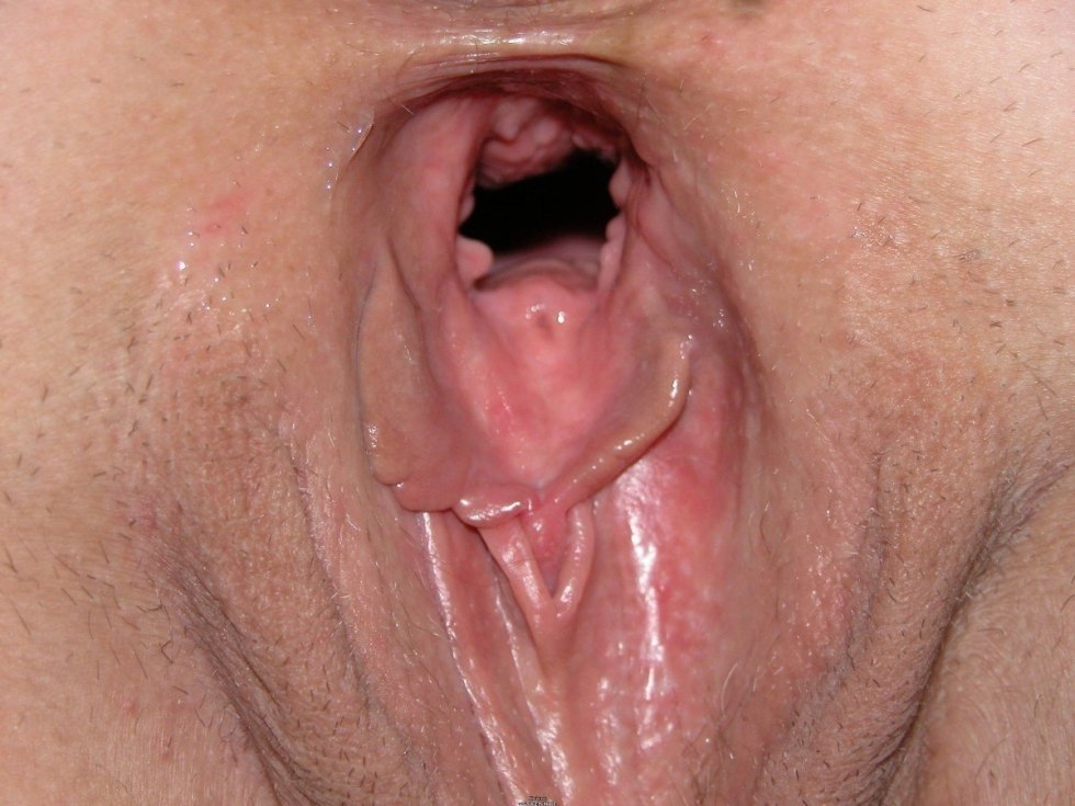 The female vagina is expanding