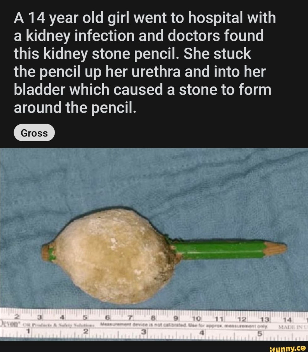 Objects in the urethra