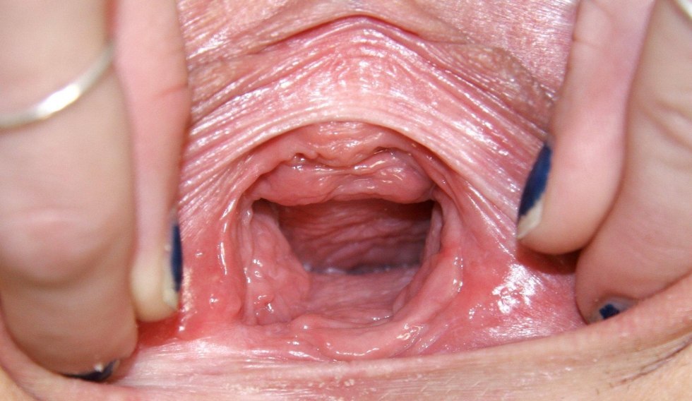Close -up vagina inside