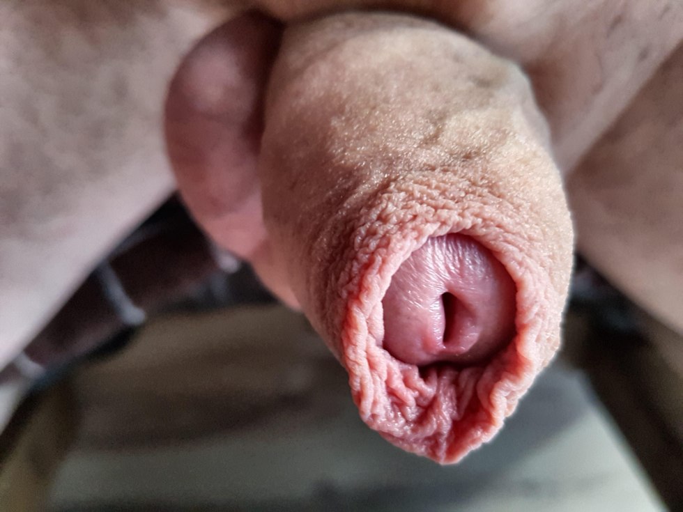Member with long foreskin
