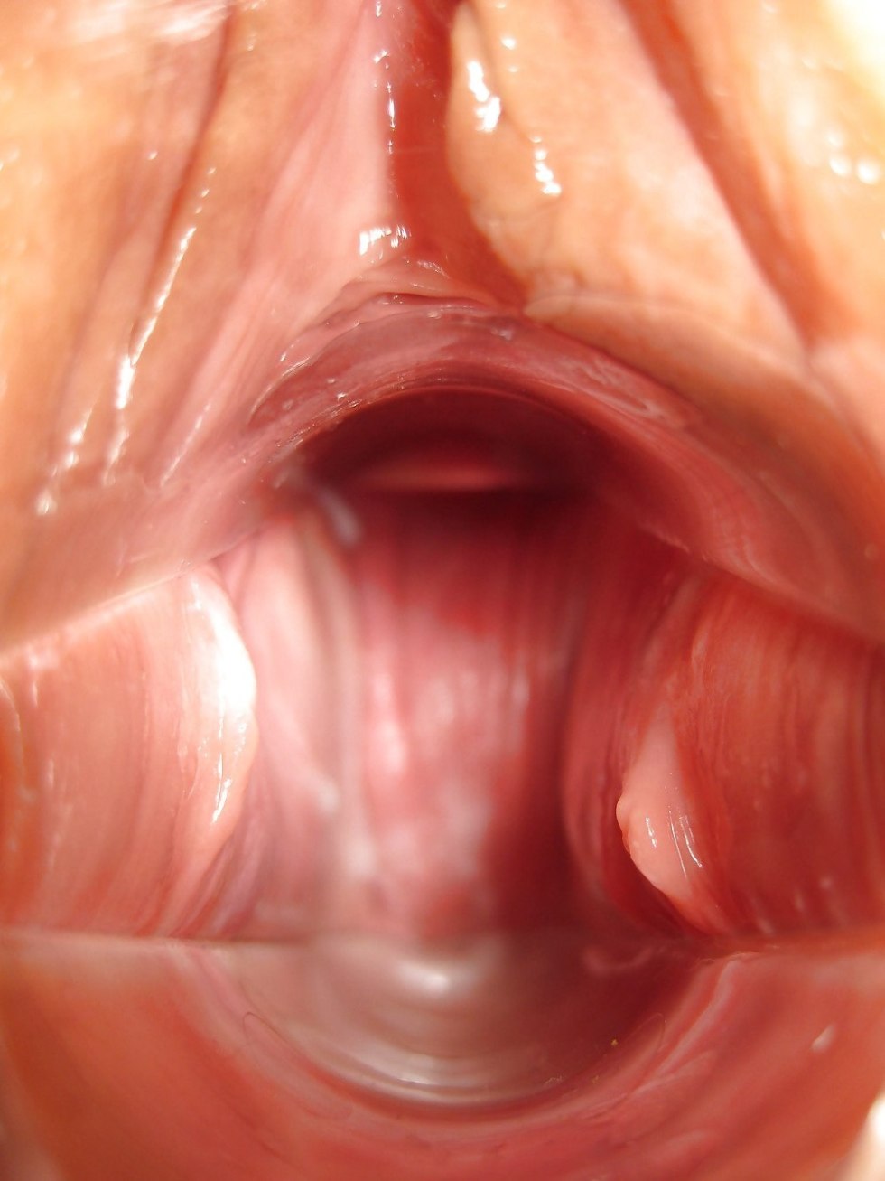 The camera inside the vagina