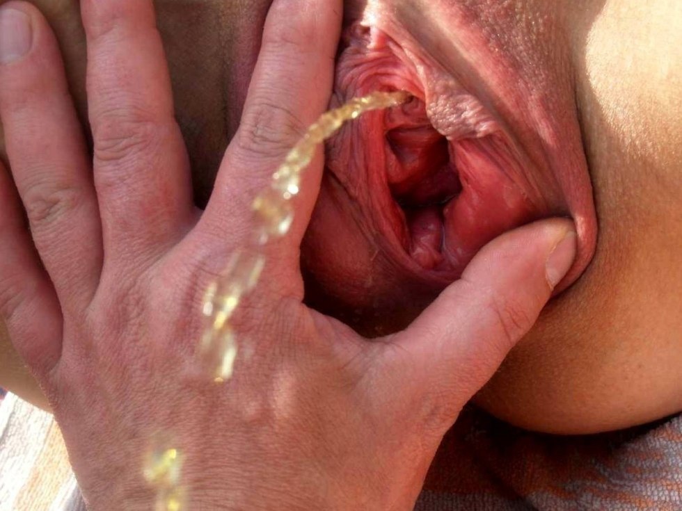 The insides of the vagina