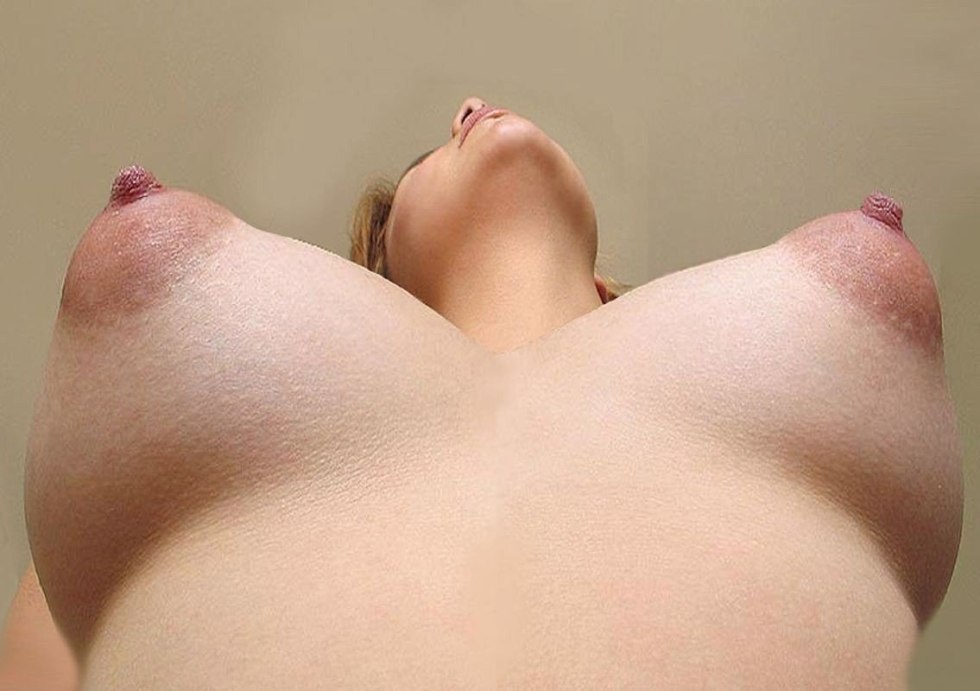 Convex nipples