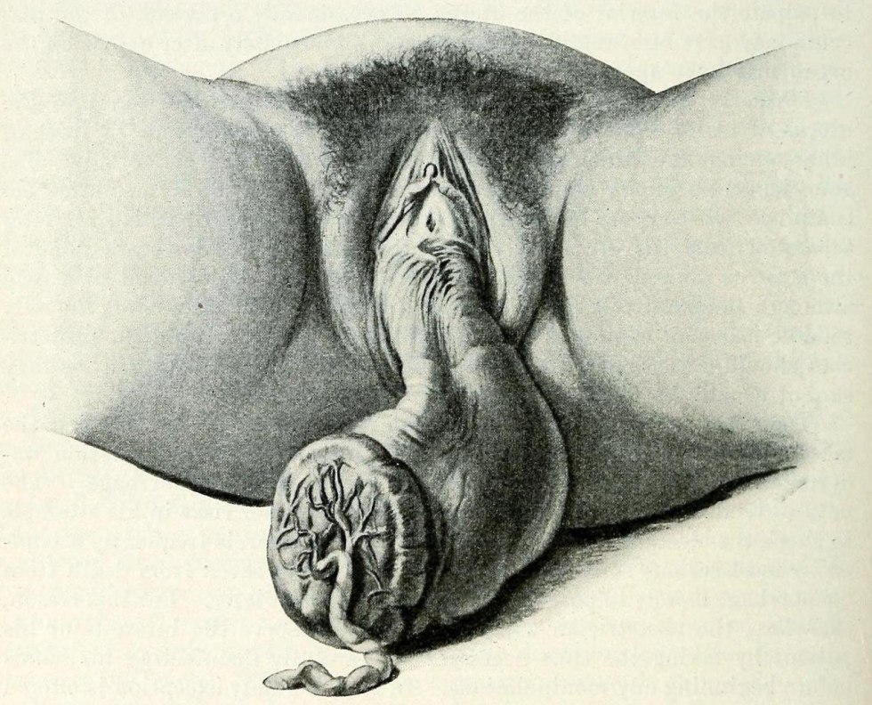 Drawing the genitals