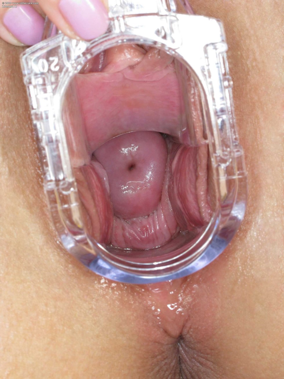 The insides of the vagina