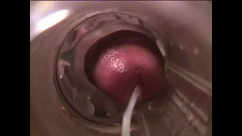 Cum in the uterus through the funnel