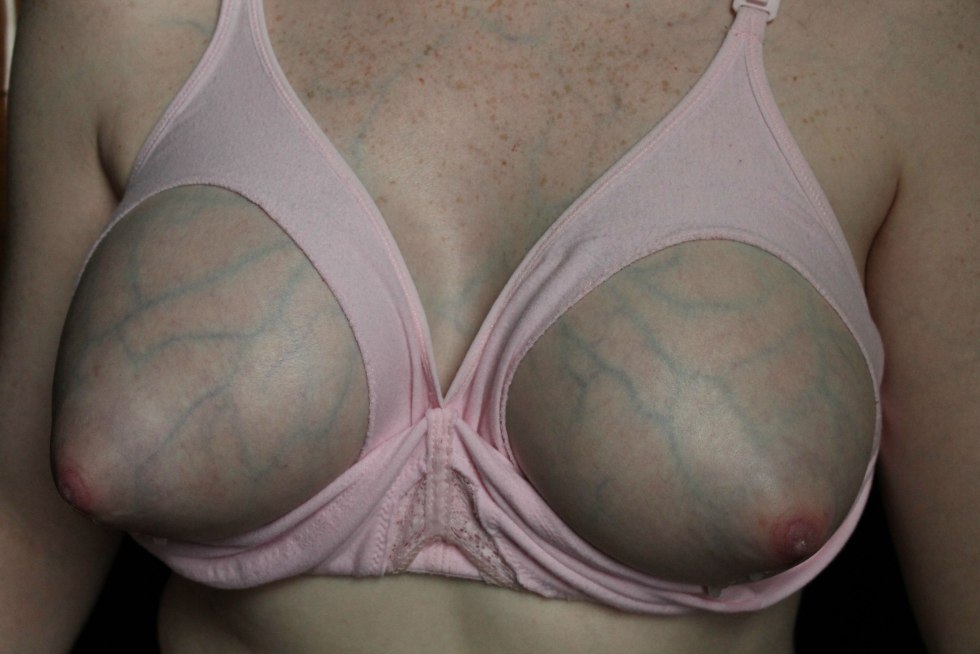 Big female breasts with veins