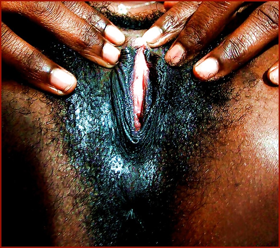 Vagina of African girl
