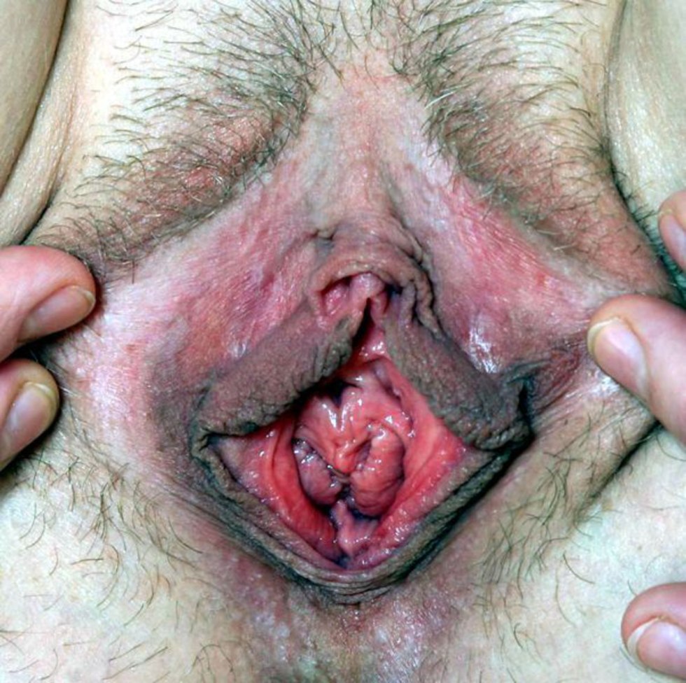 The most terrible female vagina