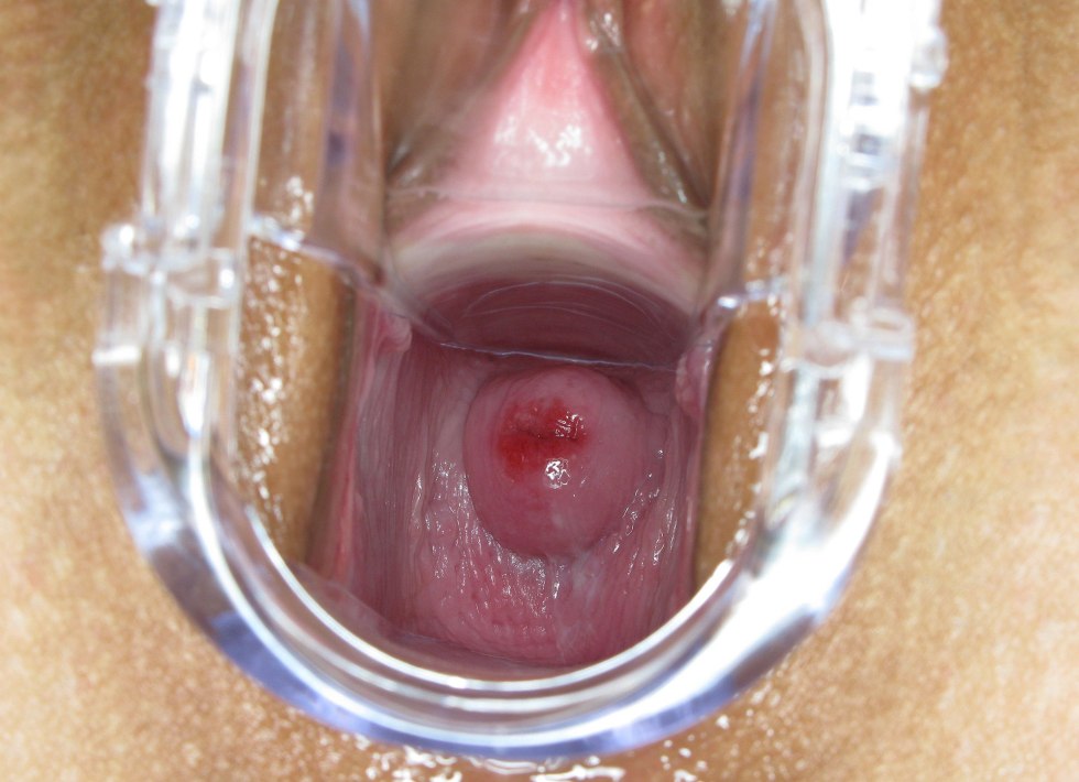 Vagina from the inside in the section