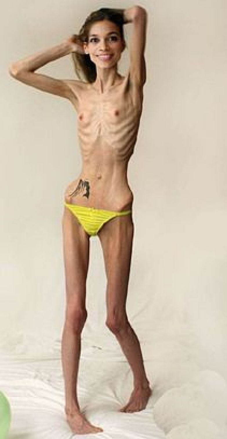 Anorexic with small breasts
