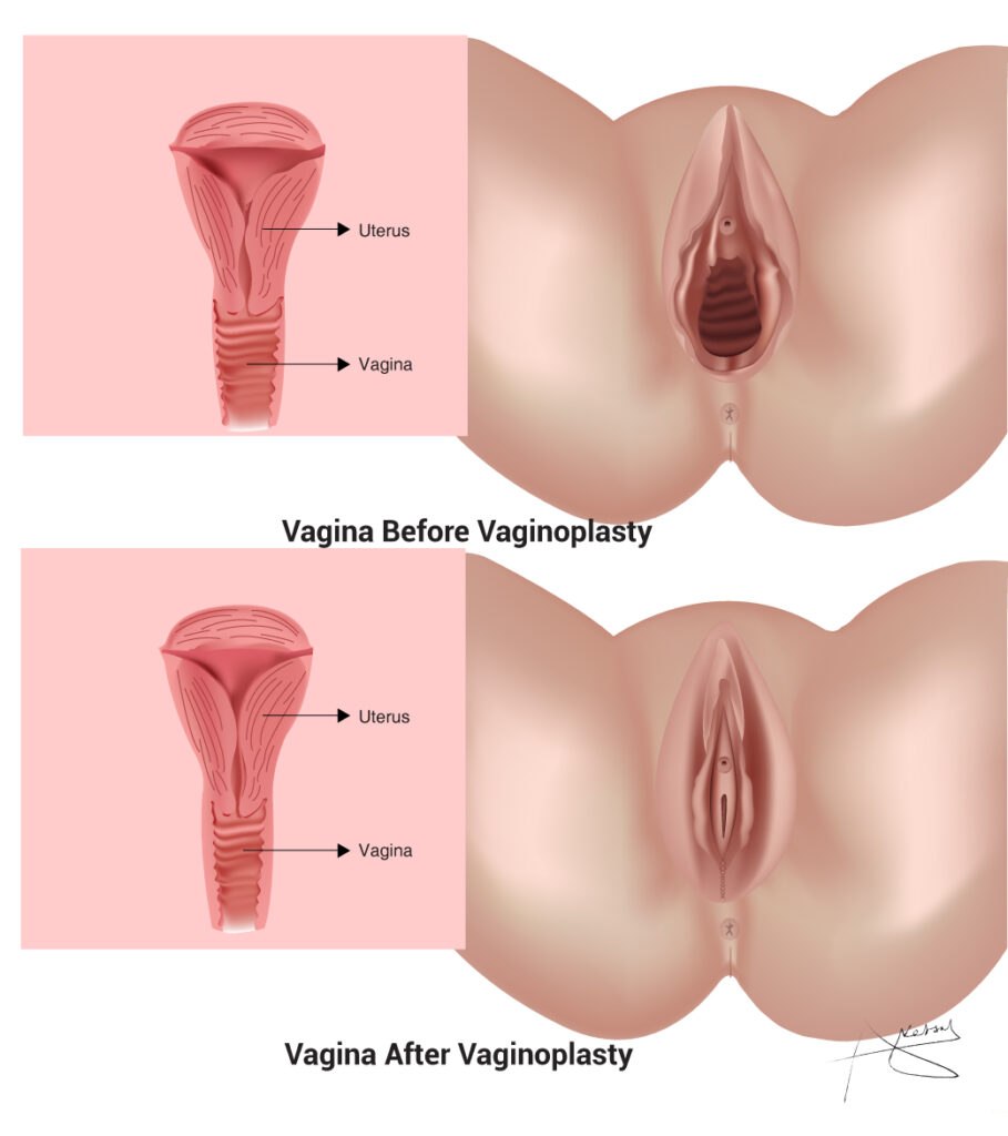 Normal vagina of a woman