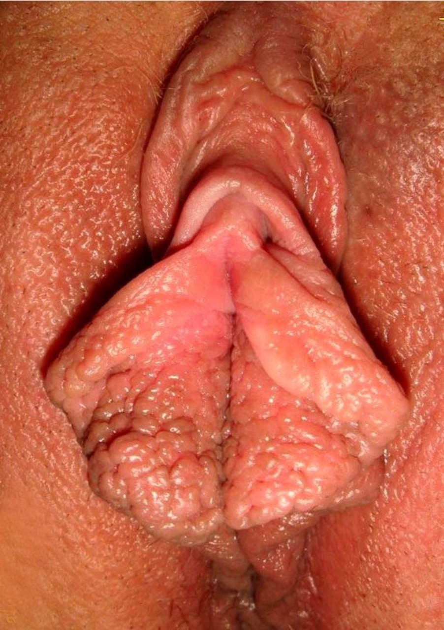 Female genital organ close -up