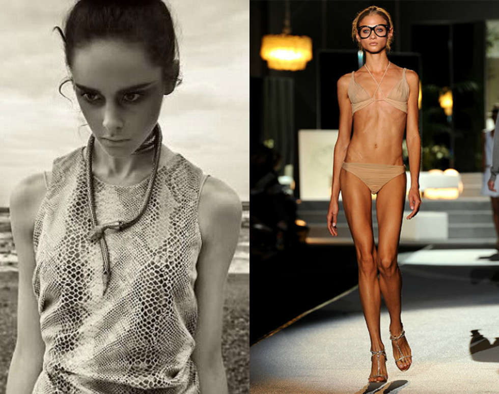 Naked anorexics