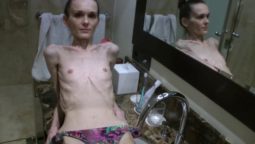 Naked anorexic old women