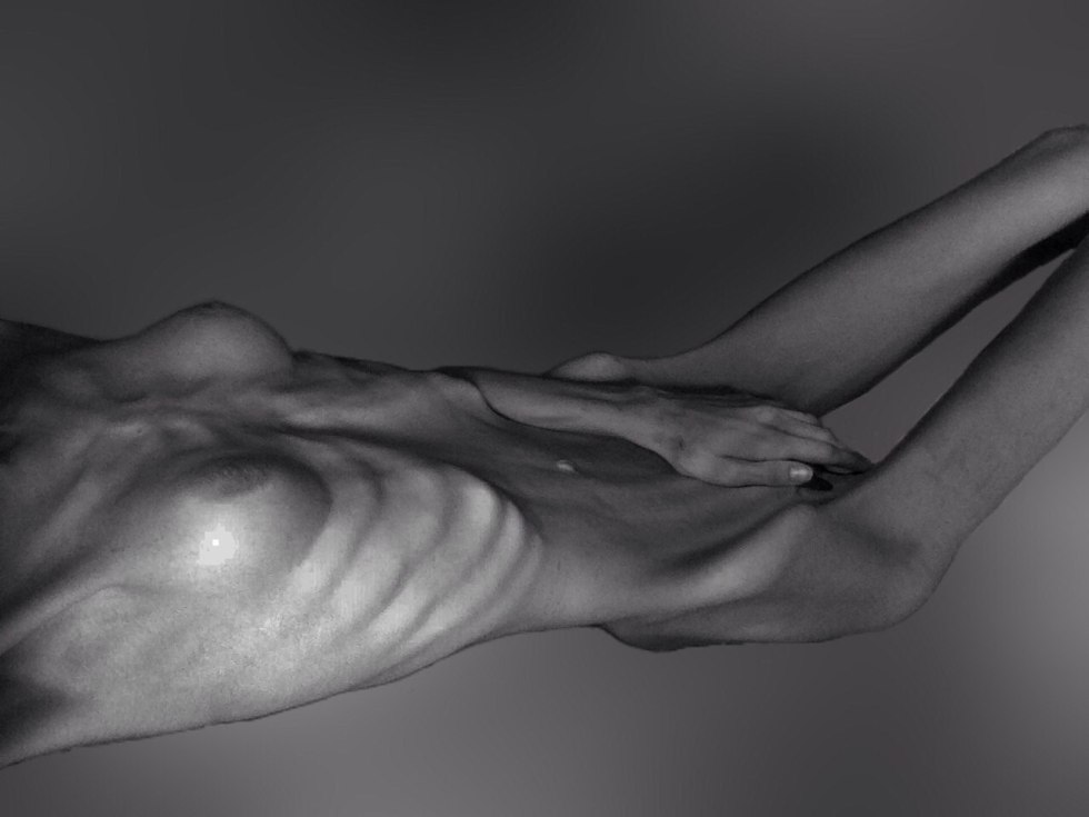 Naked thin anorexics
