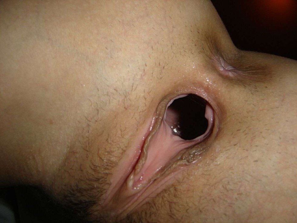 Private large holes close -up