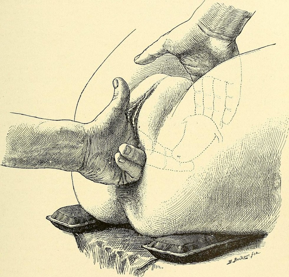 Drawing the genitals