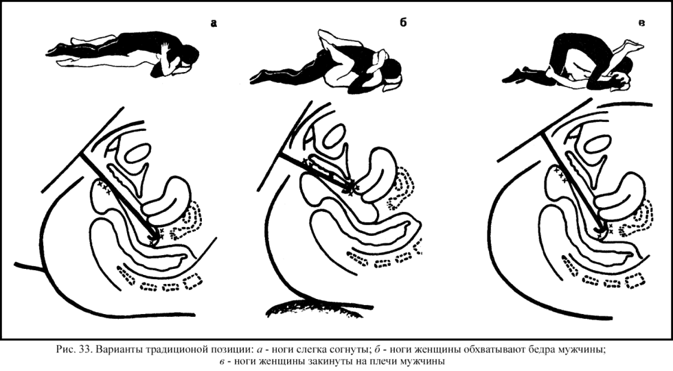 The penetration scheme of the penis into the anus