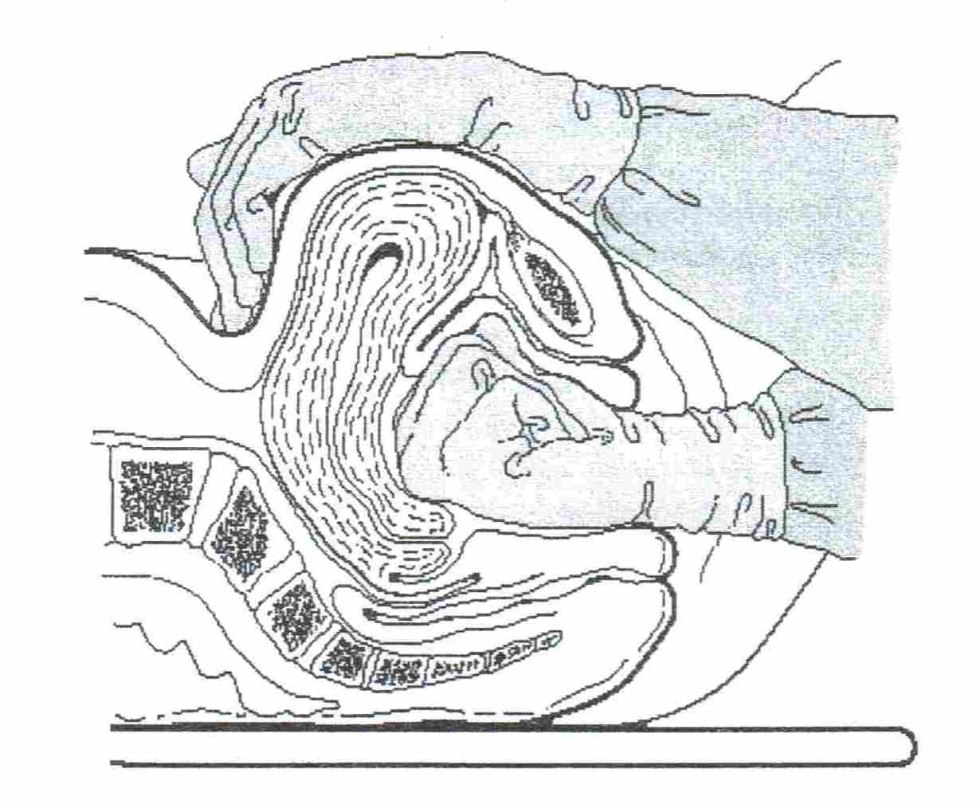 Gynecological uterine massage