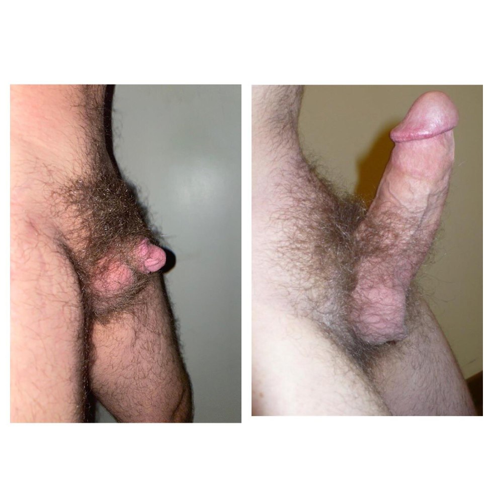 Male dick before an erection