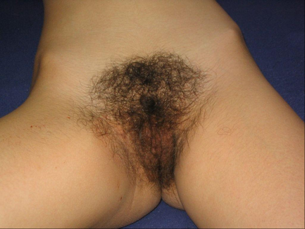 Pussy with hair on the pubis