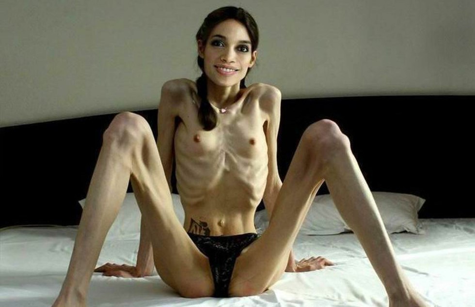 Naked thin anorexica
