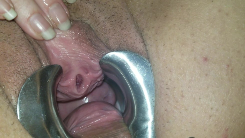 Masturbation of female urethra