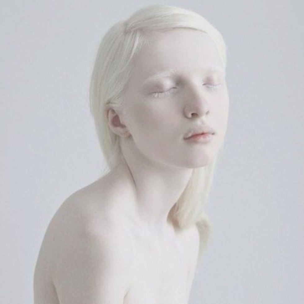 Nastya Zhlikova Albino