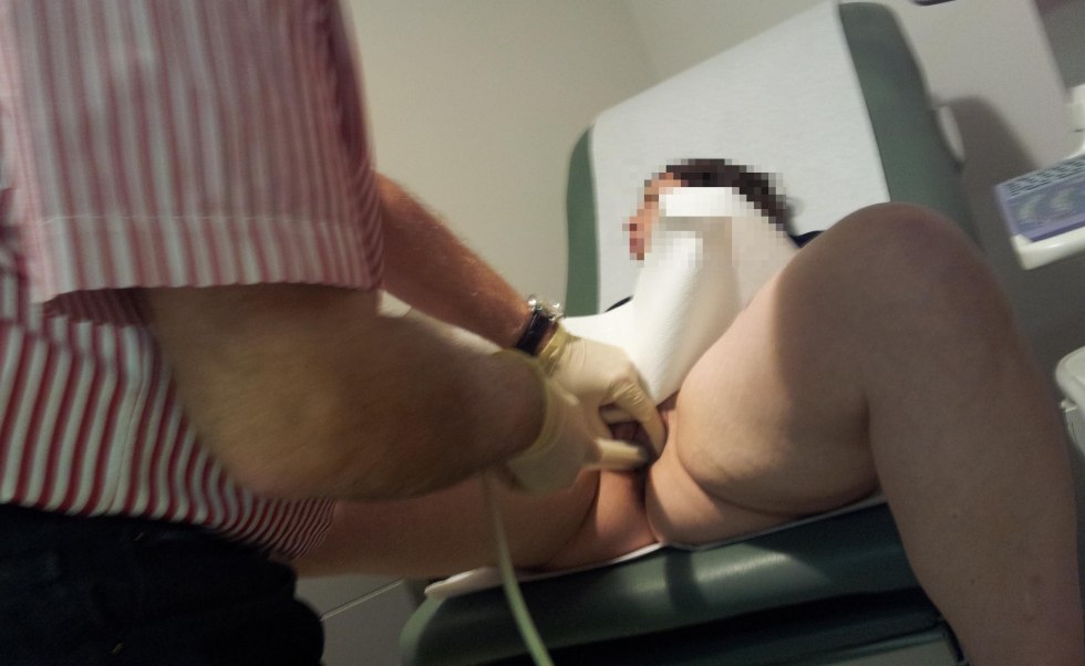 Peeping in gynecology