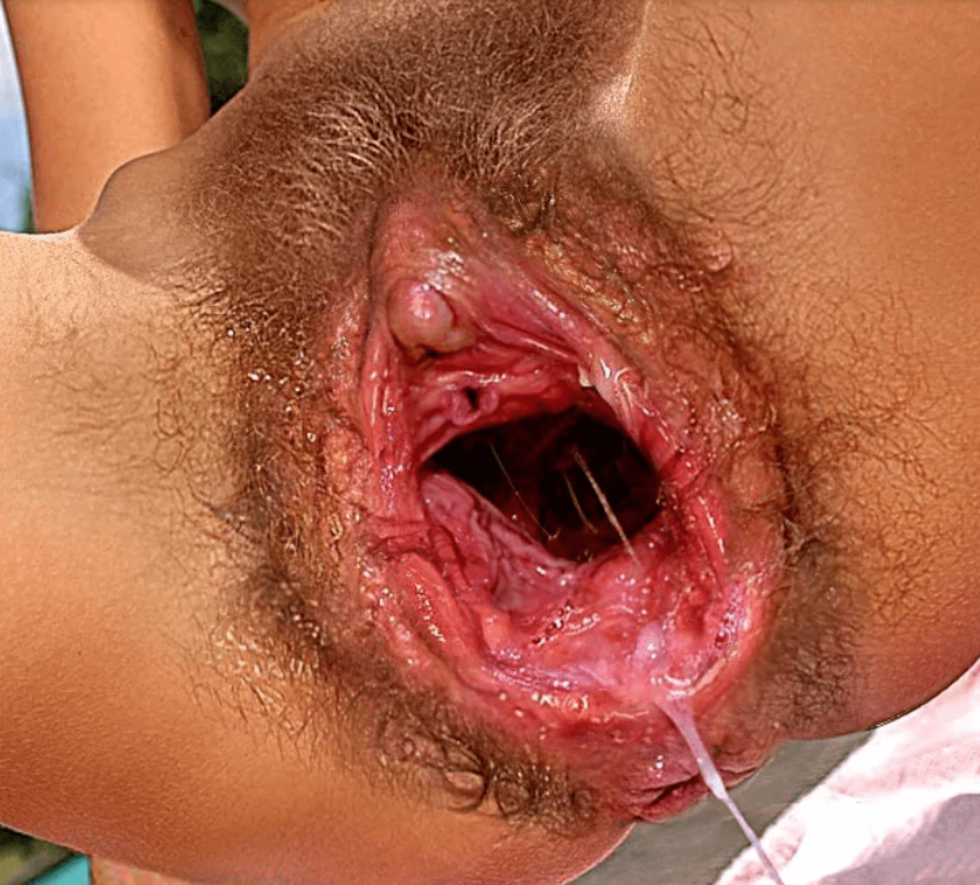 The largest female pussy