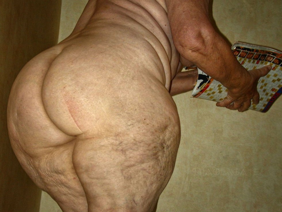 Old elderly with cellulite