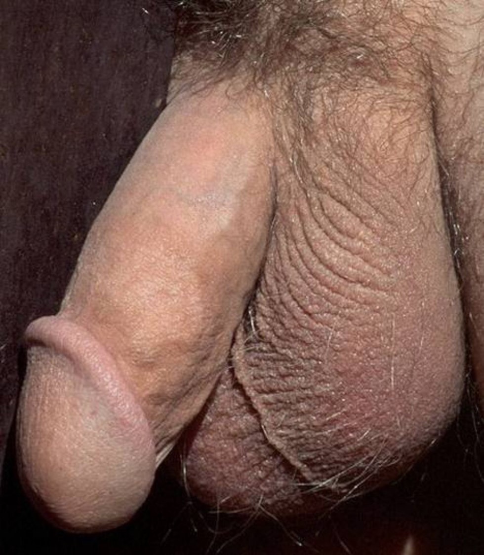 Member thick hairy and hanging