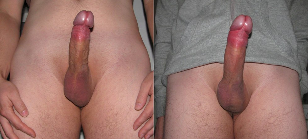 Male dick after a vacuum pump