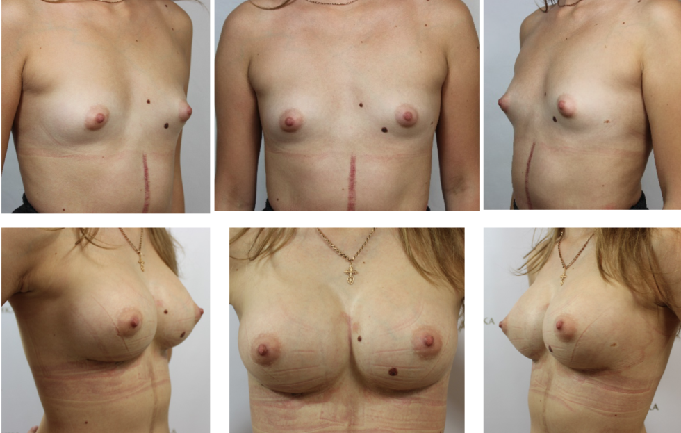 Different forms of female boobs