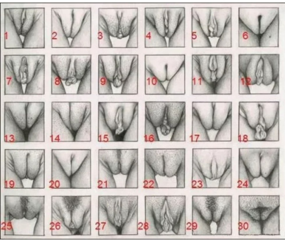 Types of vagina and their names