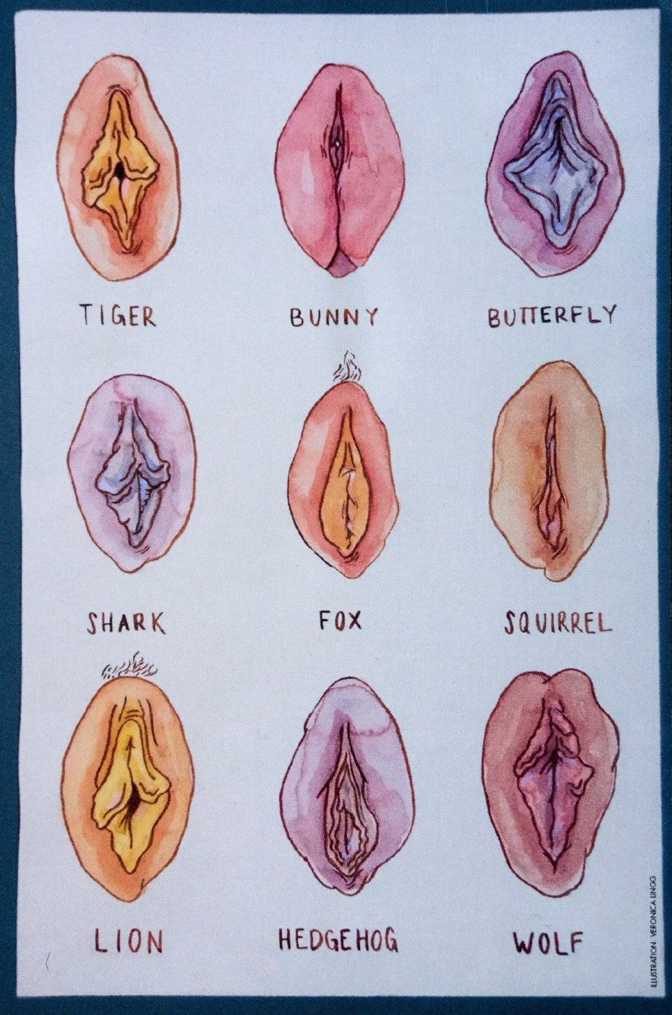 Type of female vagina