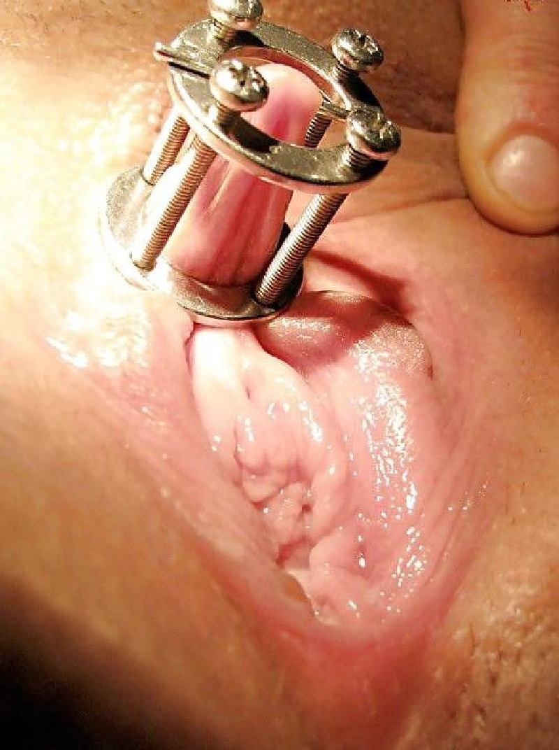 Vagina Expressor Ring