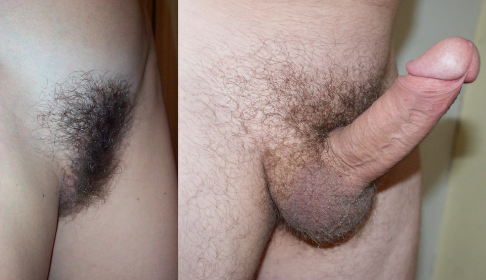 Pubic hair in men and women
