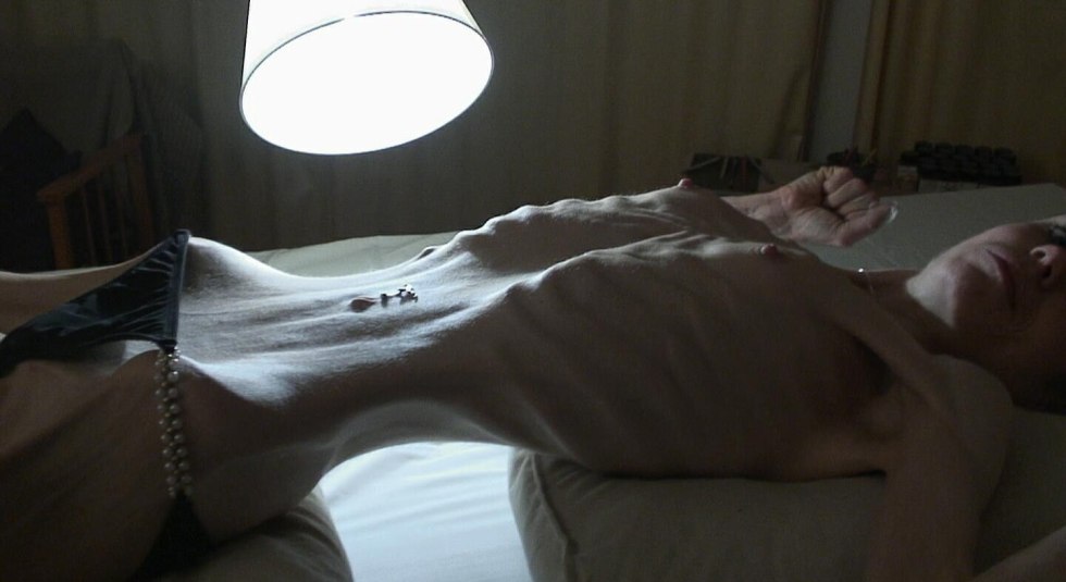 Naked anorexic girls