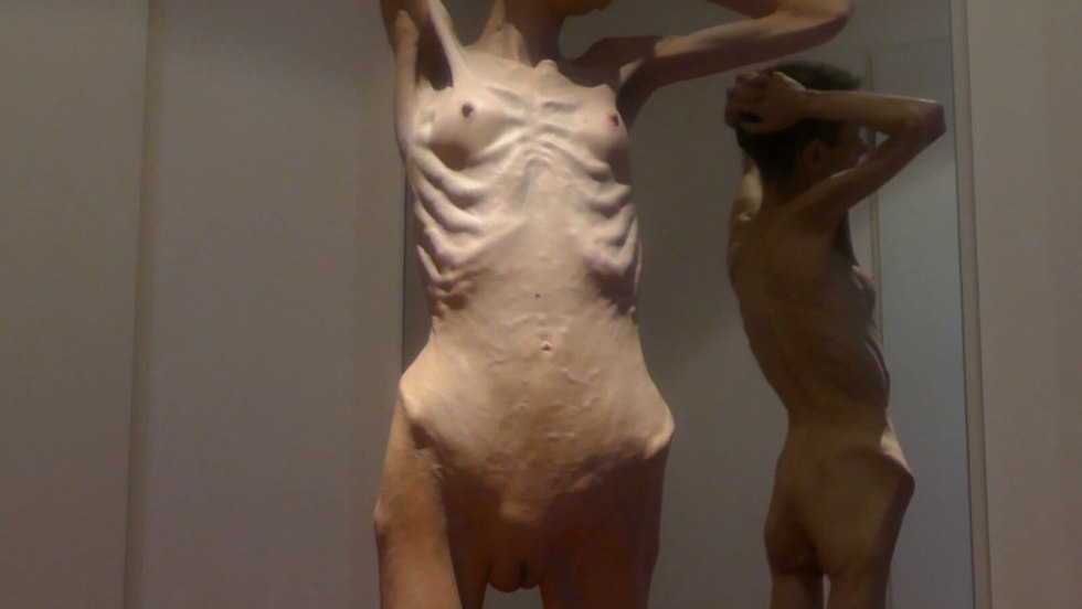 Naked women with anorexia