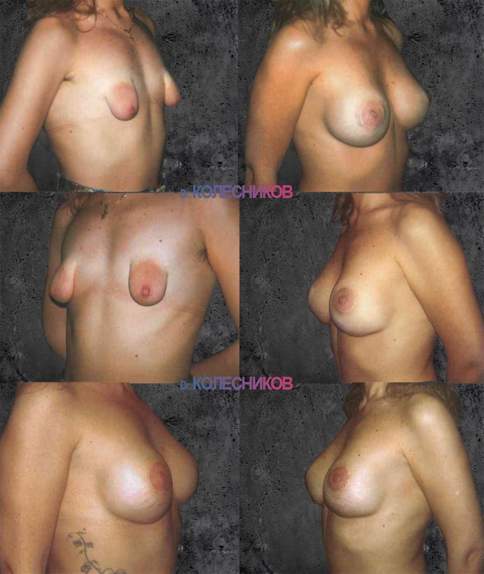 Naked boobs of various shapes