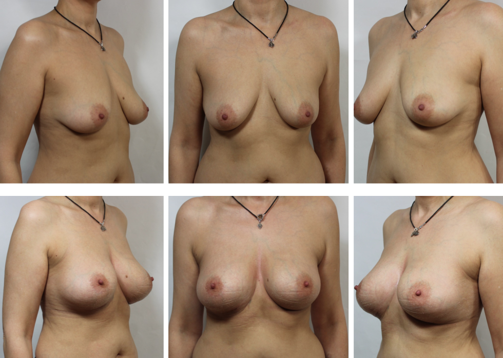 Hamperful shape of the chest