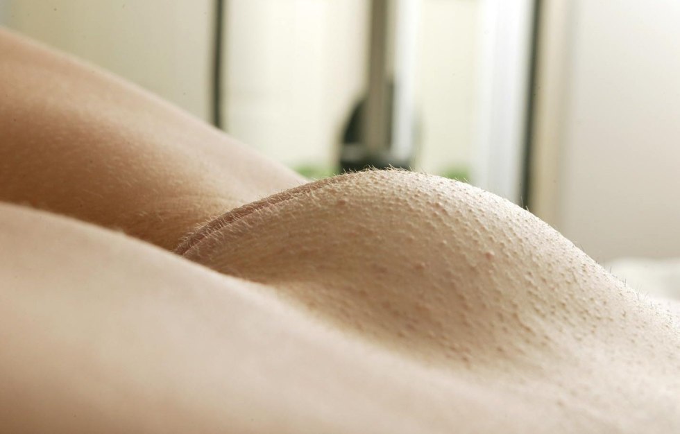 Beautiful convex pubis