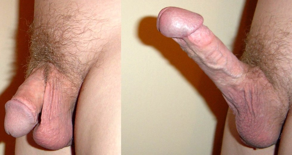A small cut penis