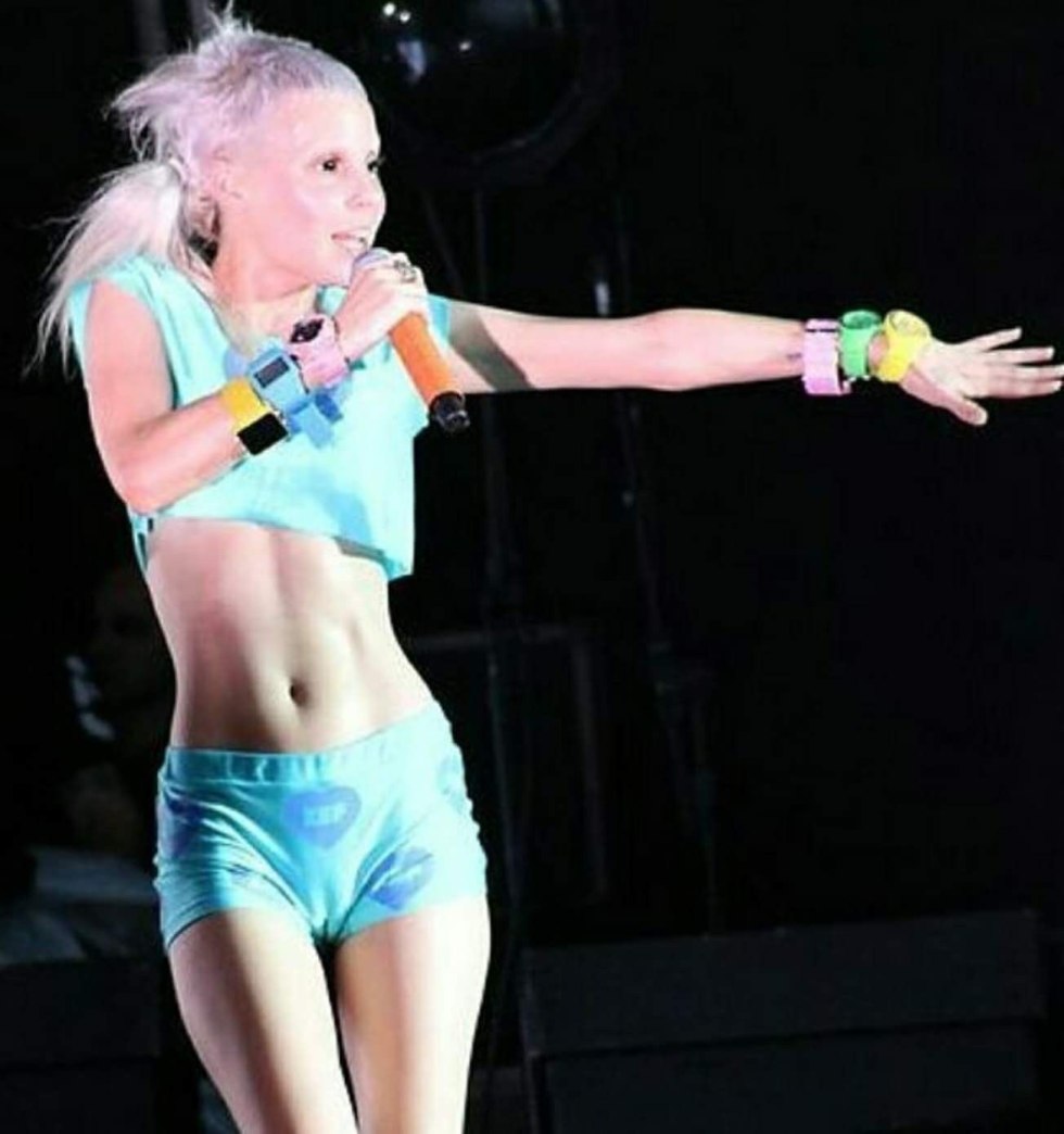 Die Antwoord soloist