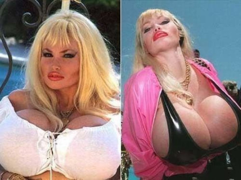 Naked plastic surgery