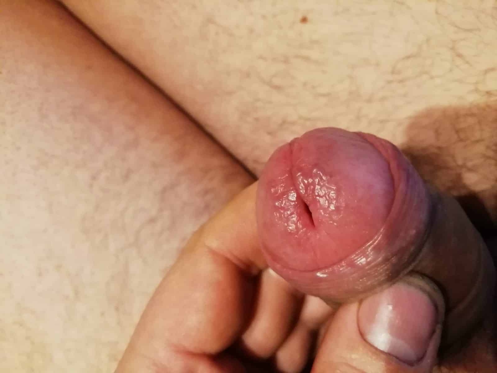 половые болезни мастурбация (120) фото